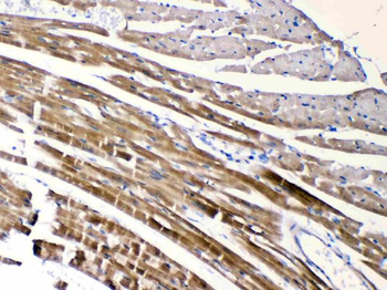 Nicotinic Acetylcholine Receptor alpha 5/CHRNA5 Rabbit Polyclonal Antibody