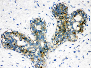 ARSA Rabbit Polyclonal Antibody