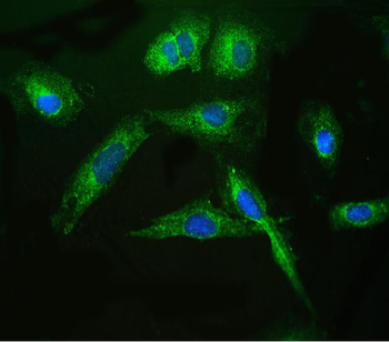 ARSA Rabbit Polyclonal Antibody