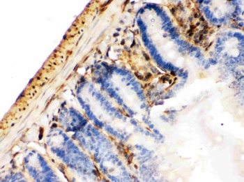 Galectin 1/LGALS1 Rabbit Polyclonal Antibody