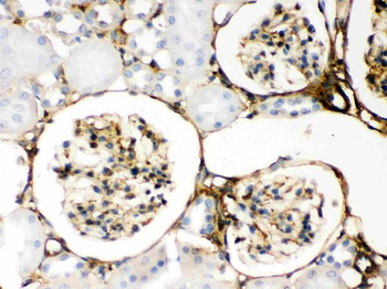 Galectin 1/LGALS1 Rabbit Polyclonal Antibody