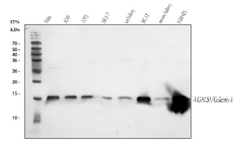 Galectin 1/LGALS1 Rabbit Polyclonal Antibody