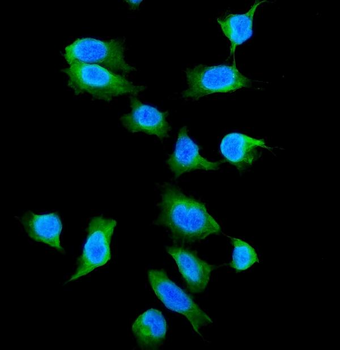 Galectin 1/LGALS1 Rabbit Polyclonal Antibody