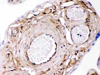 Galectin 1/LGALS1 Rabbit Polyclonal Antibody