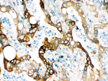Fatty Acid Synthase/FASN Rabbit Polyclonal Antibody