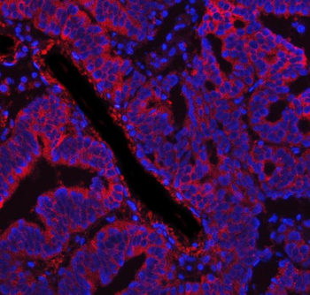 Fatty Acid Synthase/FASN Rabbit Polyclonal Antibody