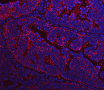 Fatty Acid Synthase/FASN Rabbit Polyclonal Antibody