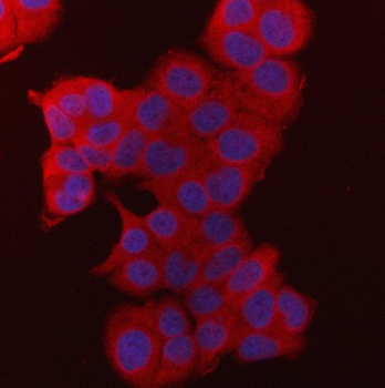 Fatty Acid Synthase/FASN Rabbit Polyclonal Antibody