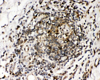 Ribonuclease Inhibitor/RNH1 Rabbit Polyclonal Antibody
