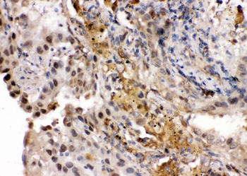 Ribonuclease Inhibitor/RNH1 Rabbit Polyclonal Antibody