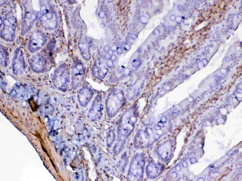Galectin 1/Lgals1 Rabbit Polyclonal Antibody
