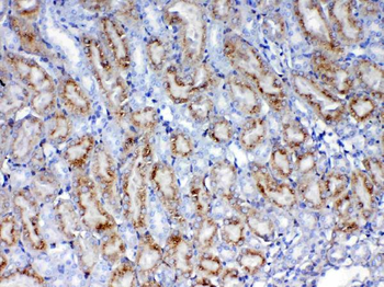 Galectin 1/Lgals1 Rabbit Polyclonal Antibody