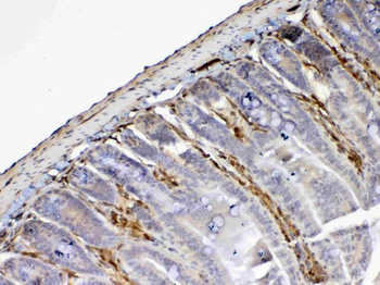 Galectin 1/Lgals1 Rabbit Polyclonal Antibody