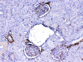 Galectin 1/Lgals1 Rabbit Polyclonal Antibody