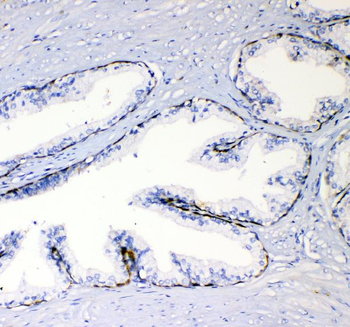 TL1A/TNFSF15 Rabbit Polyclonal Antibody