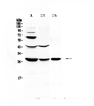 TL1A/TNFSF15 Rabbit Polyclonal Antibody