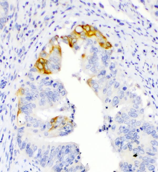 TL1A/TNFSF15 Rabbit Polyclonal Antibody