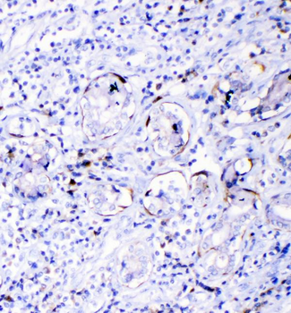 TL1A/TNFSF15 Rabbit Polyclonal Antibody