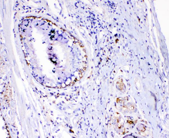 TL1A/TNFSF15 Rabbit Polyclonal Antibody