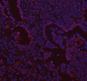 VE-Cadherin CDH5-/VE Rabbit Polyclonal Antibody
