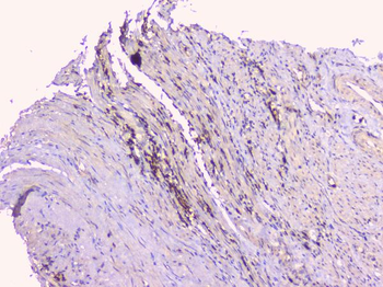 Osteoprotegerin/TNFRSF11B Rabbit Polyclonal Antibody