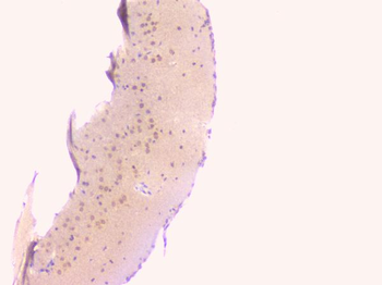Osteoprotegerin/TNFRSF11B Rabbit Polyclonal Antibody