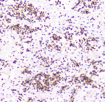 Osteoprotegerin/TNFRSF11B Rabbit Polyclonal Antibody