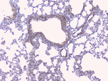 Aromatase/CYP19A1 Rabbit Polyclonal Antibody