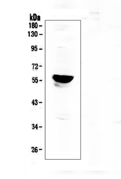 Aromatase/CYP19A1 Rabbit Polyclonal Antibody