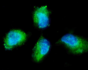 PKC gamma/PRKCG Rabbit Polyclonal Antibody