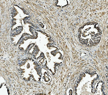 NDUFB10 Rabbit Polyclonal Antibody