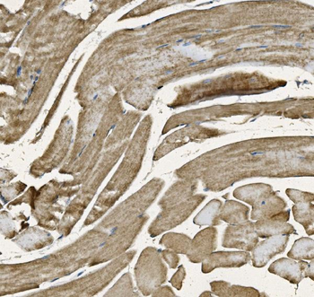 NDUFB10 Rabbit Polyclonal Antibody