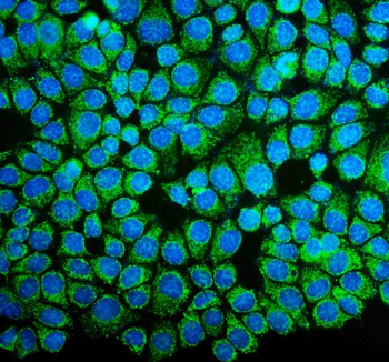 NDUFB10 Rabbit Polyclonal Antibody