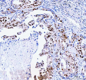 FEN1 Rabbit Polyclonal Antibody