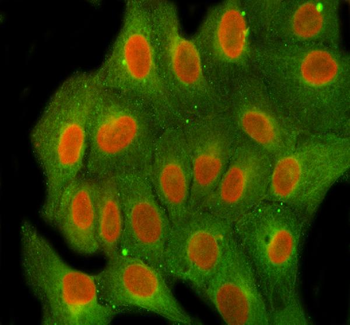 FEN1 Rabbit Polyclonal Antibody
