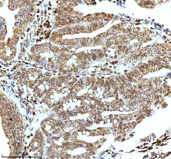 Histone H3 HIST1H3A/B/C/D/E/F/G/H/I/J Rabbit Polyclonal Antibody