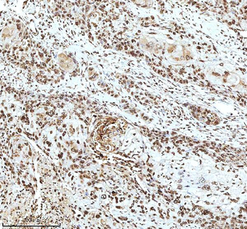 Histone H3 HIST1H3A/B/C/D/E/F/G/H/I/J Rabbit Polyclonal Antibody