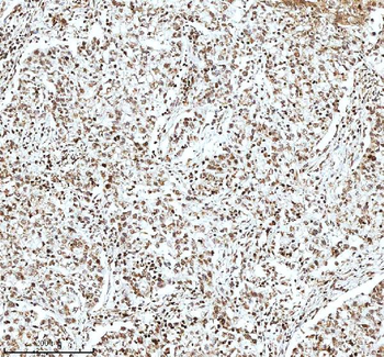 Histone H3 HIST1H3A/B/C/D/E/F/G/H/I/J Rabbit Polyclonal Antibody