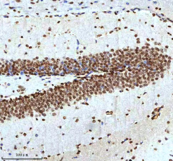 Histone H3 HIST1H3A/B/C/D/E/F/G/H/I/J Rabbit Polyclonal Antibody