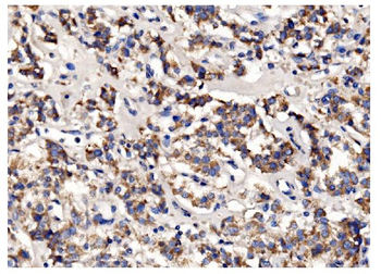 PFKFB2 Rabbit Polyclonal Antibody