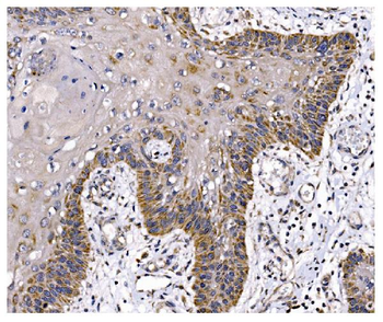 PFKFB2 Rabbit Polyclonal Antibody