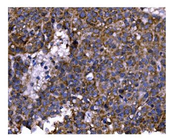 PFKFB2 Rabbit Polyclonal Antibody