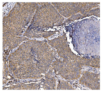 PFKFB2 Rabbit Polyclonal Antibody