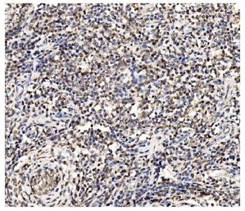 PFKFB2 Rabbit Polyclonal Antibody