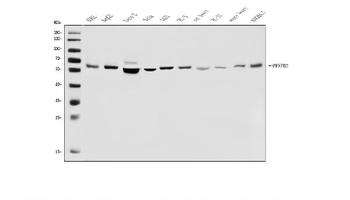 PFKFB2 Rabbit Polyclonal Antibody