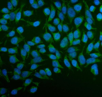PFKFB2 Rabbit Polyclonal Antibody