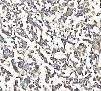 5HT1B/HTR1B Rabbit Polyclonal Antibody