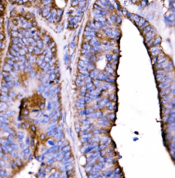 5HT1B/HTR1B Rabbit Polyclonal Antibody
