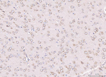 RPL29 Rabbit Polyclonal Antibody