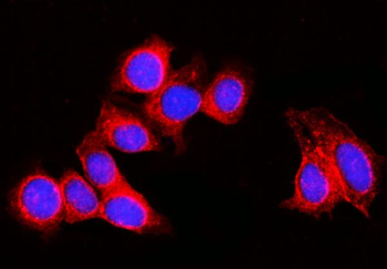 RPL29 Rabbit Polyclonal Antibody